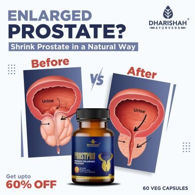 Enlarged Prostate 2